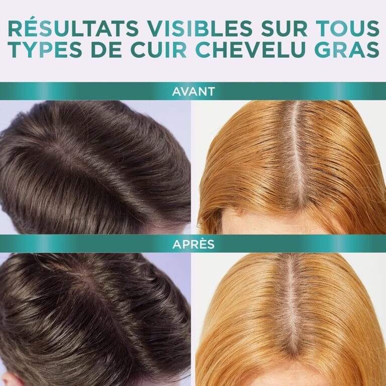 L'Oréal Paris - Shampooing Purifiant 72h pour Cuir Chevelu Gras - Complexe à l'Acide Salicylique et Hyaluronique - Protocole de Soin Capillaire -...